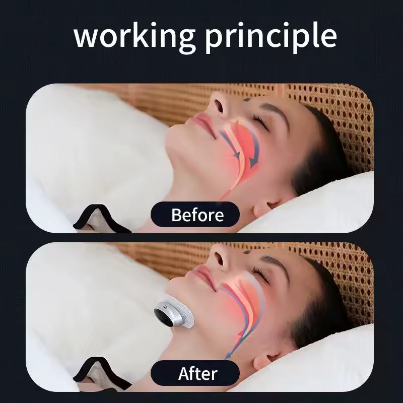 Nasal breathing aid for comfortable sleep