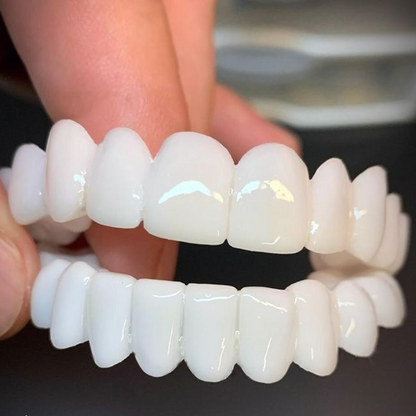 Removable dental prosthesis | Comfortable fit for everyday use