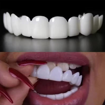 Removable dental prosthesis | Comfortable fit for everyday use